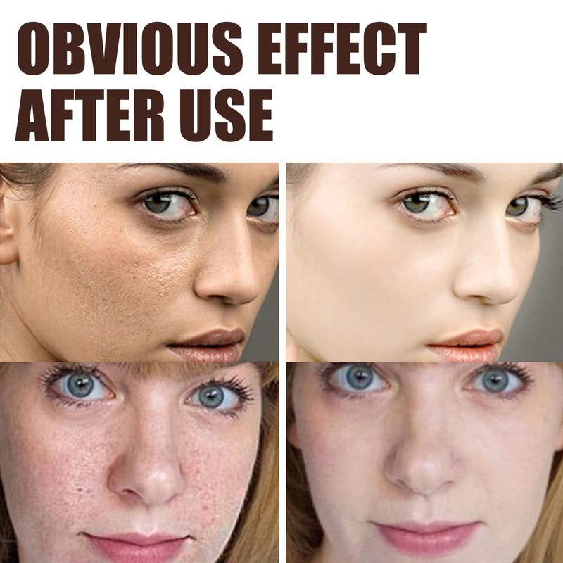 Retinol Anti-Wrinkle Moisturizer